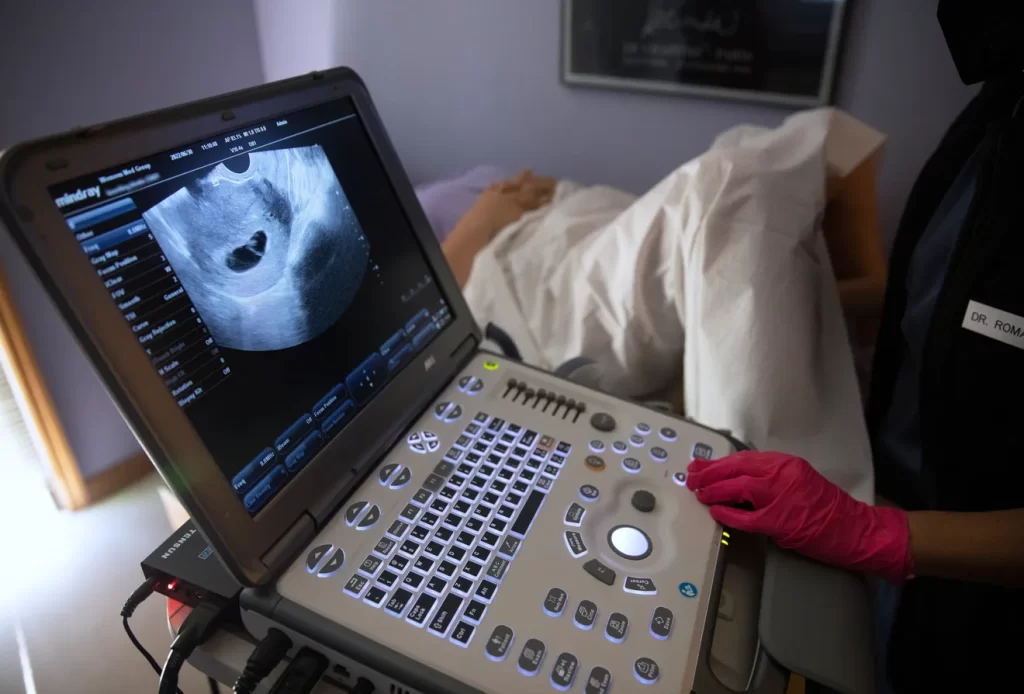 Politicians making Ohio women's health a game. Abortion rights can't wait to 2024